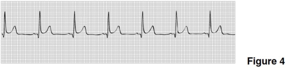   -The heart rate in Figure 4 is closest to A) 100. B) 70. C) 150. D) 50.