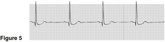   -In Figure 5,the heart rate is closest to A) 100. B) 40. C) 75. D) 55.