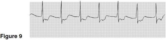   -In Figure 9,the P waves are A) upright,rounded,preceding the QRS. B) inverted preceding the QRS. C) not visible. D) inverted following the QRS.