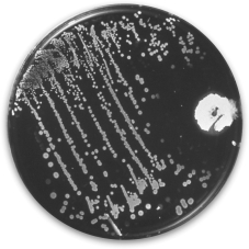 What is happening in the figure shown?   A)  The mold on the left is producing a compound that inhibits the growth of the bacterial colonies on the right. B)  The mold on the left is outcompeting the bacterial cells for nutrients and therefore is growing faster. C)  The bacterial cells on the right are inhibiting the growth of the mold on the left. D)  The mold and bacterial cells are growing in a symbiotic relationship.
