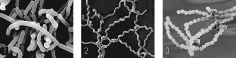 In the figure below,which depicts cocci in chains?   A)  1 B)  2 C)  3 D)  none of the labeled areas