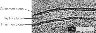 This transmission electron micrograph shows a   A)  Gram-positive cell envelope. B)  Gram-negative cell envelope. C)  eukaryotic cell membrane. D)  mycobacterial envelope.