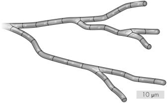 The fungal structure shown is best described as a   A)  hyphapseudopod. B)  mycelium. C)  mushroom. D)  fruiting body.