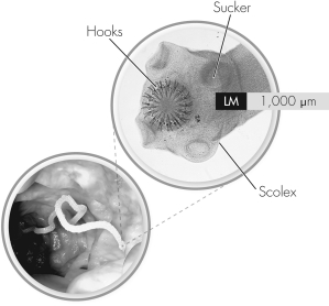 The organism shown in this figure is a(n)    A)  nematode. B)  cestode. C)  trematode. D)  arthropod.