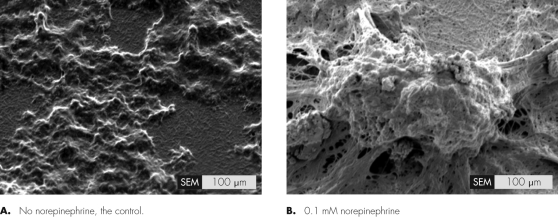 Observe the figure shown.Based on what you see,what can you conclude?   A)  Norepinephrine stimulates biofilm formation of Staphylococcus epidermidis. B)  Norepinephrine is inhibited by Staphylococcus epidermidis. C)  Staphylococcus epidermidis is able to use norepinephrine as a carbon source. D)  Norepinephrine has no effect on Staphylococcus epidermidis.