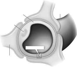 Label the figure shown.   