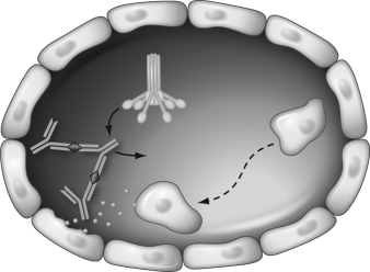 What is the end result of the reaction in the immune complex reaction demonstrated in the figure below?   A)  IgG is directed against cell membrane antigens. B)  Complement is activated. C)  Neutrophils are attracted and release enzymes. D)  Endothelial cells are damaged.