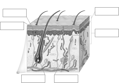 Using the figure below,label the following cellular components of the skin and describe their function. A.Keratinocytes B.Dermis C.Epidermis D.Langerhans cells E.Hair follicle F.Sweat gland   