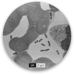 The bipolar staining seen in the small bacteria cells in this slide indicates the presence of ________.   