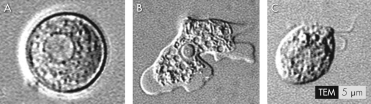 Which of the images is the amebic form that infects humans?   A)  A B)  B C)  C D)  none