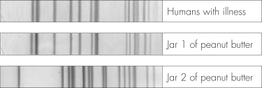 This figure shows restriction-digested DNA fragments from Salmonella enterica that have been separated by electrophoresis.The Salmonella enterica was isolated from individuals with illness and two jars of peanut butter.Which of the following accurately describes these fragments?   A)  These fragments indicate food contamination in both jars of peanut butter. B)  These fragments indicate no relationship between the ill individuals and peanut butter. C)  These fragments indicate that individuals became ill after eating peanut butter from Jar 2. D)  These fragments indicate food contamination in Jar 1, but not in Jar 2.