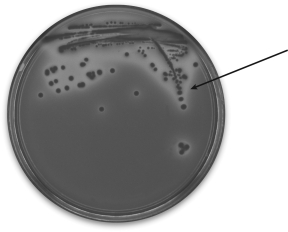<strong>The arrow in the figure shows a(n) </strong> A) gelatin suspension. B) endospore. C) colony. D) cell.