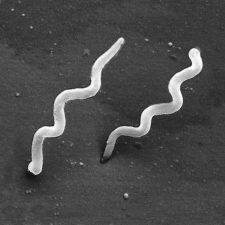 In this scanning electron micrograph of Borrelia burgdorferi,which of the following structures is visible?   A)  the outer sheath B)  cytoplasmic filaments C)  the genome D)  flagellar motors