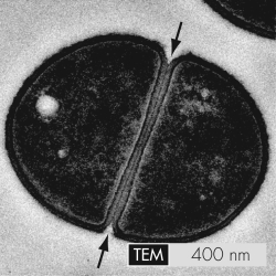 The arrows indicate the partition that separates a bacterial cell into two new daughter cells.This partition is called the   A)  stalk. B)  S-layer. C)  septum. D)  termination site.
