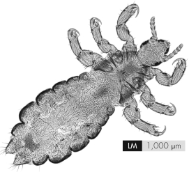 The organism shown is designed for living   A)  within the small intestine. B)  on the outer surface of the body. C)  within red blood cells. D)  on the outer surface of the liver.