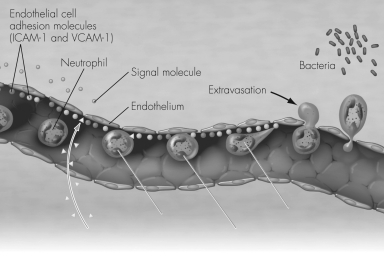 The figure below highlights the mechanism of extravasation in the inflammatory process.What will be the consequence of neutrophils that do NOT produce integrins?   A)  Neutrophils will bind to ICAM-1 and VCAM-1. B)  Neutrophils will be able to bind to the vascular wall. C)  Neutrophils will undergo extravasation. D)  Neutrophils will not lock onto endothelial adhesion molecules.