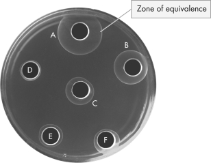 The image below is of a radial immunodiffusion assay embedded with anti-IgA antibodies.Which sample has the highest concentration of IgA antibodies?   A)  A B)  B C)  C D)  D