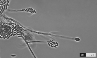 The figure below shows the fungi Fusarium.When accidentally introduced into the eye,what type of infection does this organism cause?   A)  fungal keratitis B)  parasitic keratitis C)  allergic conjunctivitis D)  trachoma