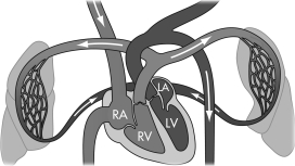 The circuit shown   A)  carries oxygenated blood to body cells. B)  removes waste from body cells. C)  replenishes oxygen in blood. D)  replenishes carbon dioxide in blood.