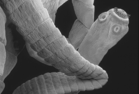 What type of organism is shown in the figure?   A)  tapeworm B)  pinworm C)  whipworm D)  hookworm