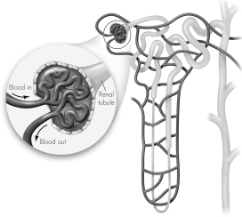 This figure shows a nephron.Please label the following on the figure and explain the steps involved in the production of urine.     · Glomerulus · Bowman's capsule · Collecting duct · Blood capillaries