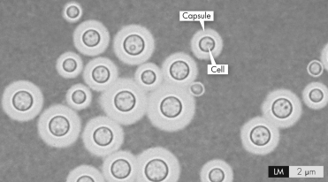 <strong>This figure shows an India ink stain of C.neoformans in a patient's CSF.What is the purpose of the capsule depicted by the arrow? </strong> A) It protects the organism from the host immune response. B) It allows the organism to spread the CNS. C) The capsule causes the persistent headache seen in most cases of coccidioidal meningitis. D) It is targeted by fluconazole as a treatment.