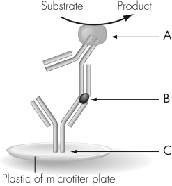 The figure shown illustrates antigen-capture ELISA.An advantage of this technique over antibody-capture ELISA is that antigen-capture ELISA   A)  leads to a speedier diagnosis. B)  is more accurate than antibody-capture. C)  does not use serum from infectious patients. D)  provides a quantitative measure of patient antibody levels.
