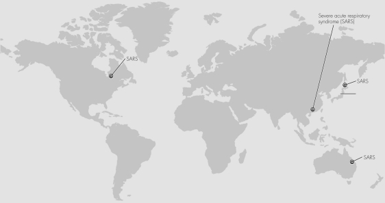 This figure shows locations of severe acute respiratory syndrome (SARS) outbreaks.Which of the following is the best explanation for the pattern of outbreaks? A) A new coronavirus appeared simultaneously in each of the locations when spontaneous mutations occurred. B) An index case patient spread a virus to other individuals who traveled rapidly around the globe. C) A previously undiagnosed virus was reported as SARS in all locations simultaneously. D) Climate change allowed mosquitoes carrying a virus to move into all of the locations.