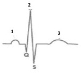   Figure 42.1 -On the ECG above, within which waveform would atrial relaxation occur? A)  1 B)  2 C)  3