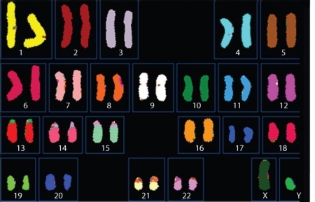   Figure 13.1 -What can you infer from the karyotype shown in Figure 13.1? A)  There is a translocation in one of the chromosome 8 homologues. B)  This individual has an abnormal number of autosomes. C)  This individual has a single sex chromosome. D)  This is a karyotype of a male.