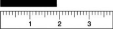 Based on the following figure, which of the measurements listed is the best estimate of the length of the object?   A) 1.8 cm B) 1.81 cm C) 1.810 cm D) 1.90 cm E) 1.9 cm
