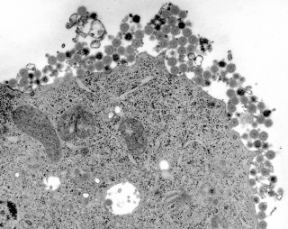Examine the photo below.This photo shows low-density lipoprotein (LDL)particles bound to receptors on the outside of a cell membrane.You view the same cell later and notice that the LDL particles are now enclosed in vesicles inside of the cell.What would you propose as the explanation for how the LDL particles arrived in their new location? Support your explanation.   