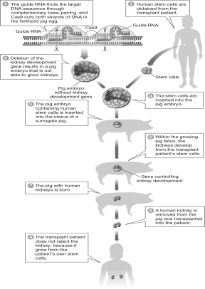 If the human transplant patient in the figure below needs a new kidney because of a genetic mutation that has made her own kidneys nonfunctional,what additional step would need to happen to produce a functional kidney for this patient?   A) The mutation that resulted in her nonfunctional kidneys should be edited or corrected before her stem cells are inserted into the pig embryo. B) Mutated kidney genes can be easily corrected after the pig embryo begins to grow. C) Nothing else needs to be done. The kidney genes in the patient's stem cells will have autocorrected themselves already. D) The mutated kidney genes should be corrected after the human kidney is harvested from the pig and before it is implanted in the human.