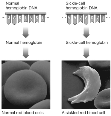 Compare the segment of DNA for normal hemoglobin DNA with the segment for sickle-cell hemoglobin DNA below.Sickle-cell disease is caused by a ________ mutation.   