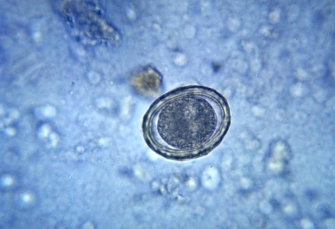 A 4-year-old child has been complaining of a stomachache and has had intermittent episodes of diarrhea. Physical examination reveals an apparently healthy child with a mildly distended abdomen. Because of the diarrhea, a fecal sample is sent for culture and for ova and parasites examination. What is the identity of that found at 400 <span class=