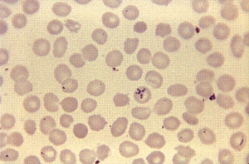 A 15-year-old boy spent most of the summer at the northern Minnesota family cabin on a lake in a densely wooded area. After returning to school in the fall, he was frequently tired and listless with periods of fever and chills. A blood sample revealed the following organism at 1000 <span class=