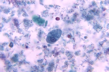 The following organism was found at 1000 <span class=