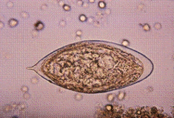 An international male student from Egypt comes to the campus clinic complaining of blood in his urine. A urinalysis reveals the parasite seen below at 400 <span class=