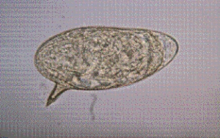 A patient who has traveled to Puerto Rico comes to a clinic with a history of diarrhea for the past 2 weeks. A fecal sample collected for O&P shows the following parasite at 400 <span class=