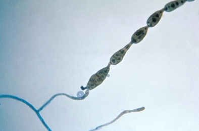This organism was isolated from a sinus aspirate of a patient with chronic sinusitis and respiratory allergies. Identify the organism from the following:   A) Candida albicans B) Alternaria spp. C) Mucor spp. D) Pseudallescheria boydii