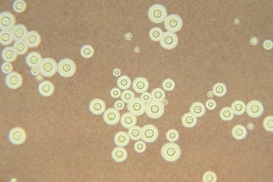 A Seattle woman with HIV complains of headaches and also displays some memory loss. Because of her history, the physician collects cerebrospinal fluid (CSF) and sends it to the laboratory for analysis. The following image is seen using India ink stain. What is the most likely identification of this organism?   A) Coccidioides immitis B) Blastomyces dermatitidis C) Cryptococcus gattii D) Candida albicans
