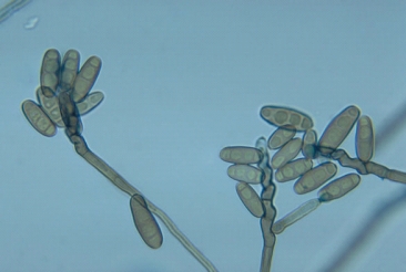The following organism was isolated from an immunocompetent patient with chronic sinusitis. This organism is most likely   A)  Mucor spp. B)  Rhizopus spp. C)  Alternaria spp. D)  Curvularia spp.