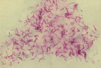 A patient returning from a trip to tropical Africa comes to his physician noting scaly patches of skin along the waistband, which are lighter in color than his normal skin. A skin scraping reveals budding yeast and short septate hyphal elements, with some branching present. This organism, shown below, is most likely   A) Malassezia furfur. B) Trichophyton schoenleinii. C) Microsporum audouinii. D) Trichophyton rubrum.