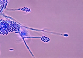 A patient who wears long-term contact lenses comes to her physician after noting a small spot on her cornea. Collection of the lesion for culture produced a fast-growing mold with a slight pink color on the surface. Microscopic review showed the following organism. This organism is most likely   A) Sporothrix schenckii. B) Fusarium spp. C) Mucor spp. D) Geotrichum spp.