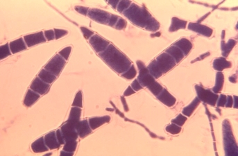 The following organism is isolated from a case of tinea capitis. The organism grew rapidly producing tan mold colonies. This organism is most likely   A)  Trichophyton rubrum. B)  Epidermophyton audouinii. C)  Fonsecaea compacta. D)  Microsporum gypseum.