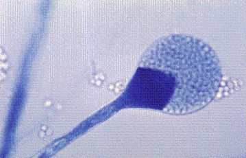 This organism was isolated from a diabetic patient with a sinus infection. The mold was extremely fast growing with a dirty white surface. Microscopic observation revealed wide sparsely septate (aseptate)  hyphae without rhizoids. This organism is most likely   A)  Mucor spp. B)  Microsporum spp. C)  Sporothrix schenckii. D)  Malassezia furfur.