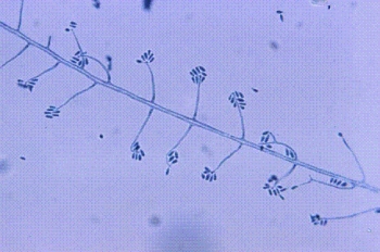 A student working for the summer at a plant nursery has a nodular lesion on his forearm that develops a draining tract. The following organism is isolated from the culture at 22° C. Identify the organism from the following:   A)  Trichosporon boydii B)  Sporothrix schenckii C)  Trichophyton rubrum D)  Microsporum canis