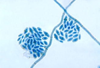 A young man notices a darkened area of skin on the palm of his hand. It seems to be increasing in size over the past 2 weeks. His health care provider collects a skin scraping for microscopic examination, which shows septate hyphal elements and budding cells. This organism is most likely   A)  Malassezia furfur. B)  Mucor spp. C)  Hortaea werneckii. D)  Microsporum canis.