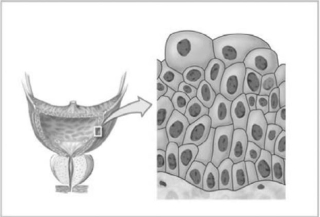   Figure 4-3 Epithelial Tissue Use Figure 4-3 to answer the following question: -Identify the type of epithelial tissue shown in the figure. A)  simple squamous B)  stratified squamous C)  pseudostratified ciliated columnar D)  simple cuboidal E)  transitional