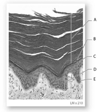   Photo Credit: Robert B. Tallitsch Figure 5-2 The Strata of the Epidermis in Thick Skin Use Figure 5-2 to answer the following questions: -The lowest level of cells of the strata,marked E,consists of A)  keratin protein. B)  collagen fibers. C)  dead cells. D)  carotene-producing cells. E)  mitotically active epithelial cells.